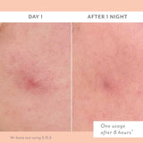 S.O.S. Totally Invisible Clarifying Liquid Patch