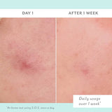 S.O.S. Totally Invisible Clarifying Liquid Patch